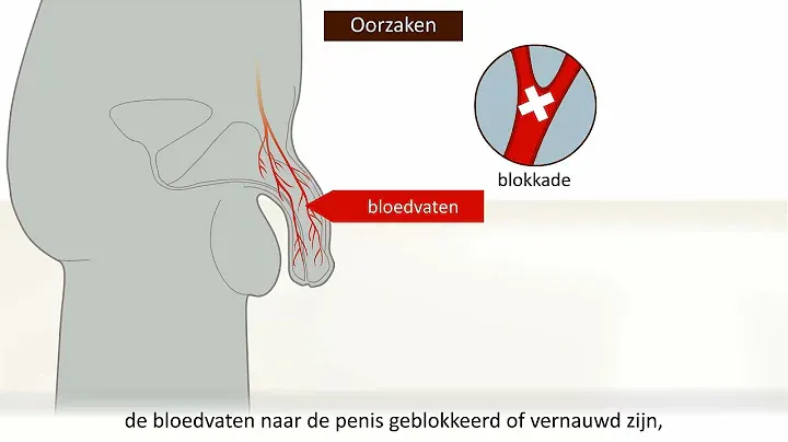 Kamagra bestellen duitsland